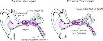 Pression eustache